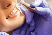 The Benefits of Professional Orthodontic Services