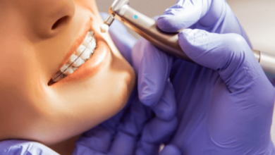 The Benefits of Professional Orthodontic Services