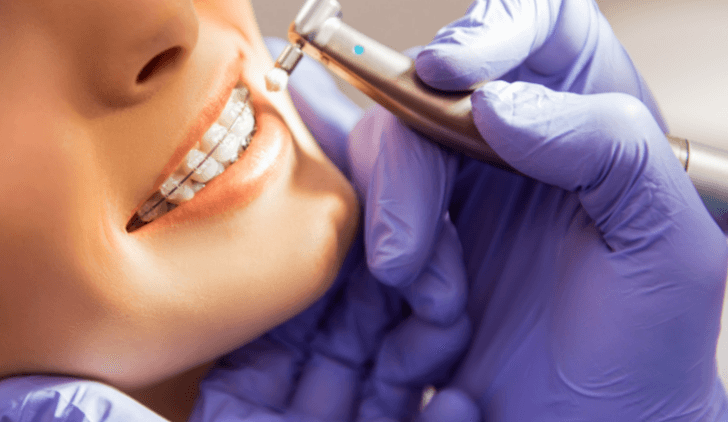 The Benefits of Professional Orthodontic Services