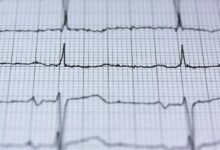 stellar pulse revenue analysis